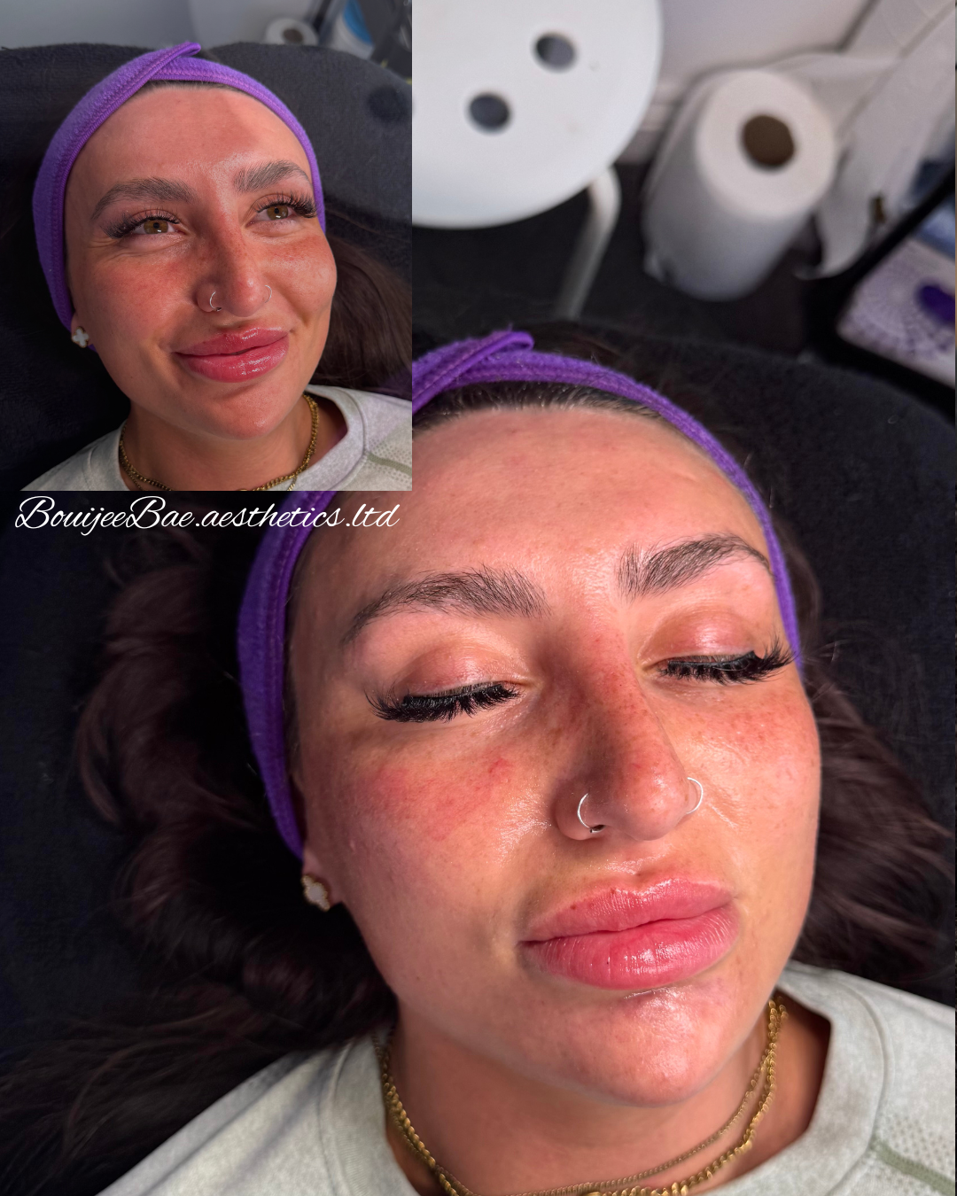 Hydrafacial LED Mask Therapy
